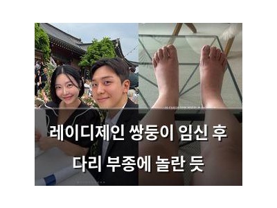 레이디제인 쌍둥이 임신 후 다리 부종에 놀란 듯